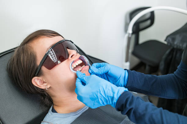 Best Knocked-Out Tooth Emergency  in Riverbend, WA